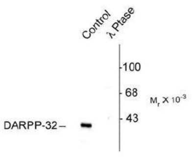 Western Blot: DARPP-32 [p Thr75] Antibody [NB300-234]